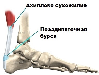 Ахиллесова Сухожилия Где Находится Фото